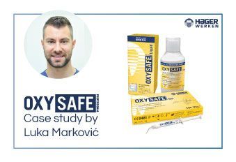 OXYSAFE® – Inovativna tehnologija na osnovi aktivnega kisika pri zdravljenju parodontalne bolezni