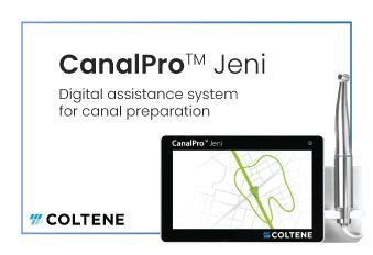 Avtomatizirajte svojo endodontijo: CanalPro Jeni in HyFlex EDM – Popolna kombinacija